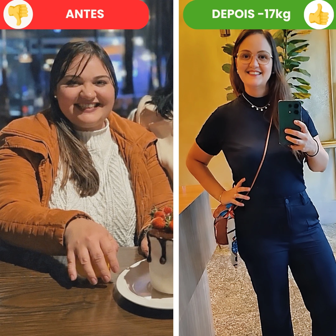 Antes e depois Aline